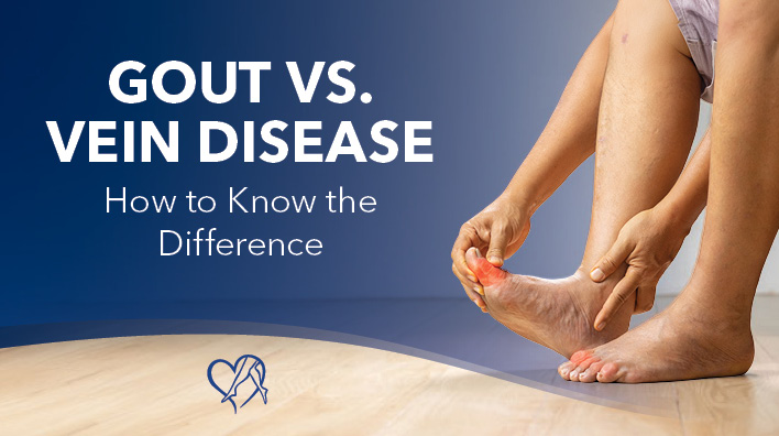 Blog Image Gout vs Vein Disease