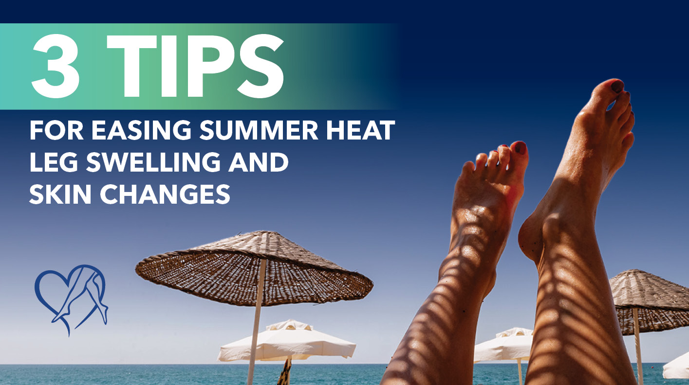 Blog Image 3 Tips for Easing Summer Heat Leg Swelling and Skin Changes