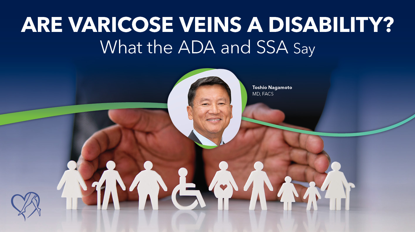 Blog Image Are Varicose Veins A Disability