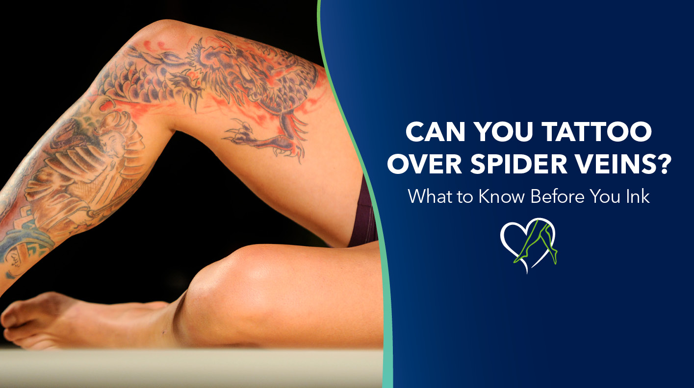 Blog Image Can You Tattoo Over Spider Veins 2026
