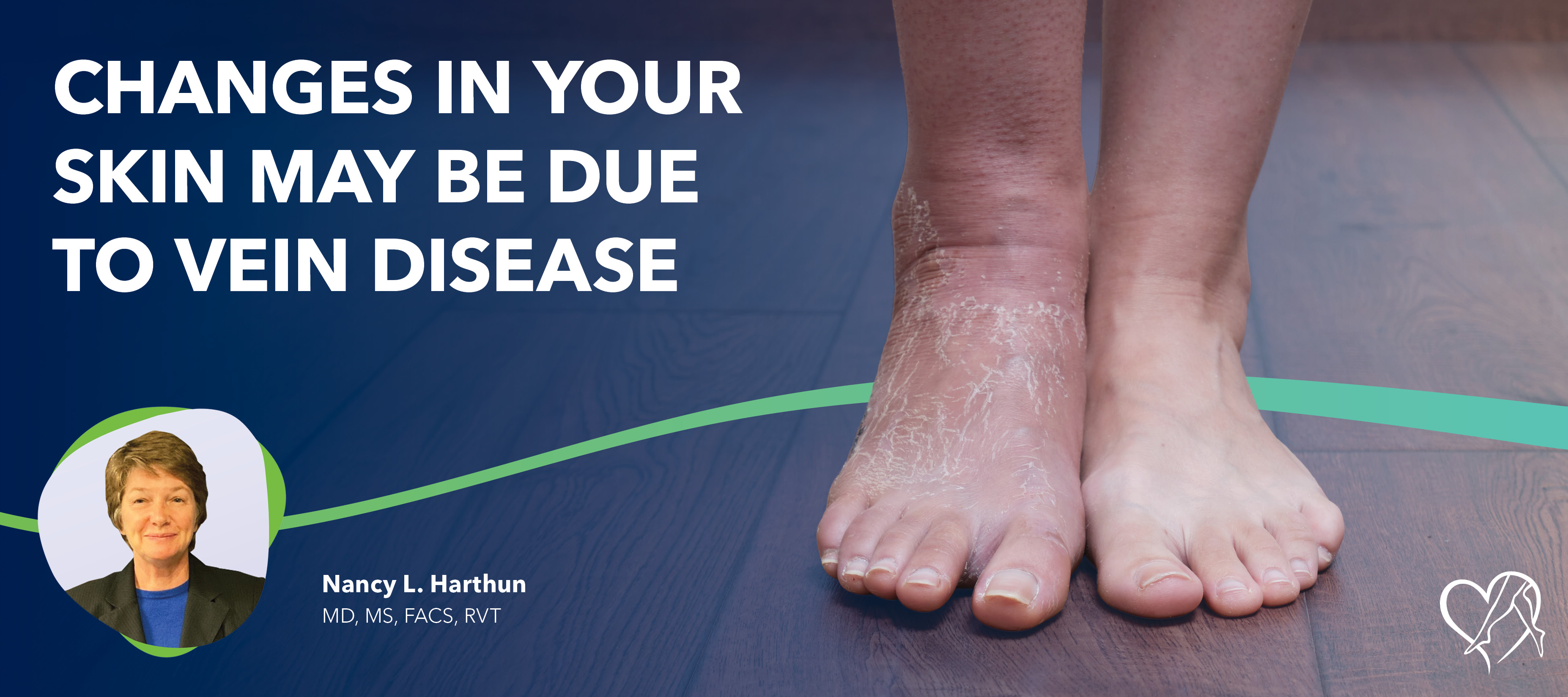 Blog Image Changes in Your Skin May be Due to Vein Disease