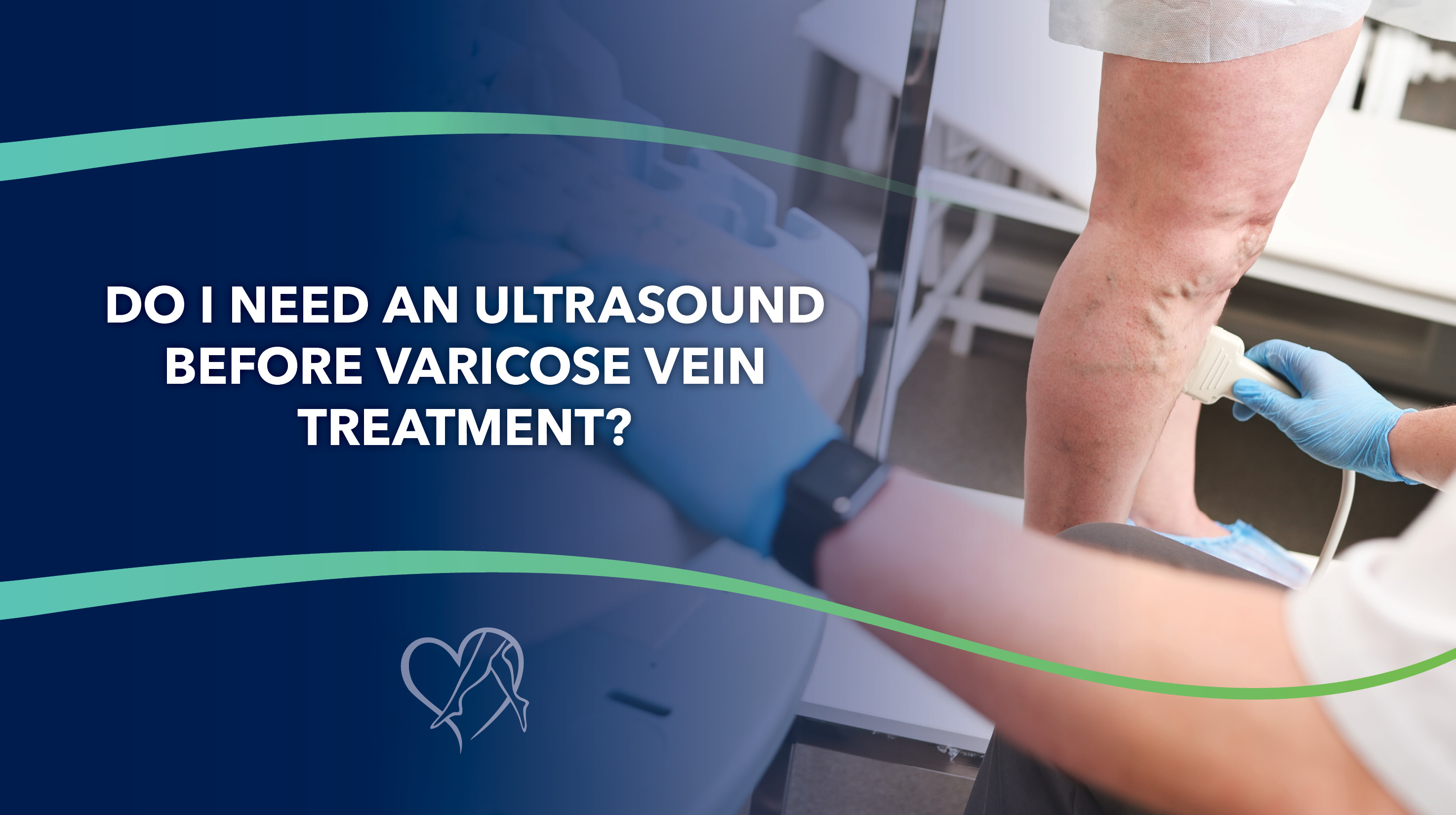 Blog Image Do I Need An Ultrasound Before Varicose Vein Treatment