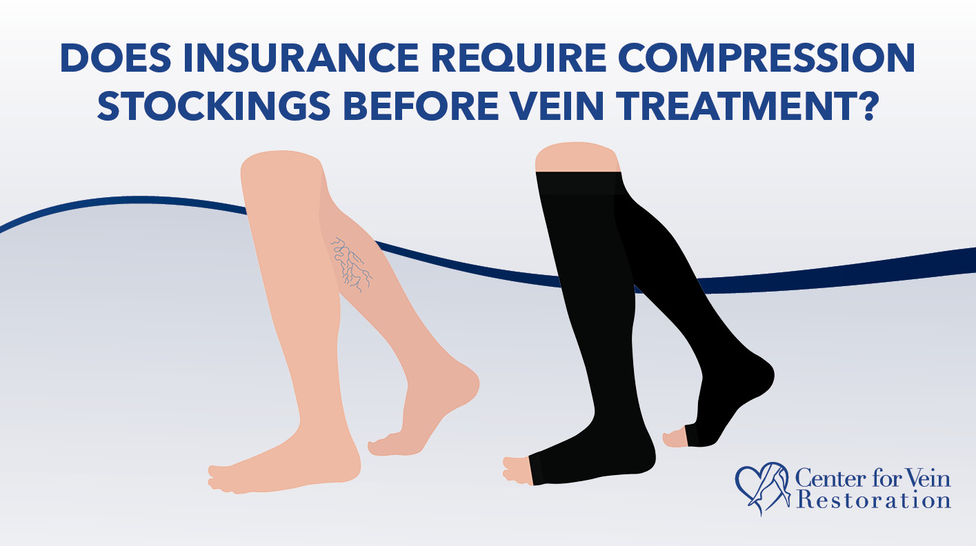 Blog Image Does Insurance Require Compression Stockings Before Vein Treatment