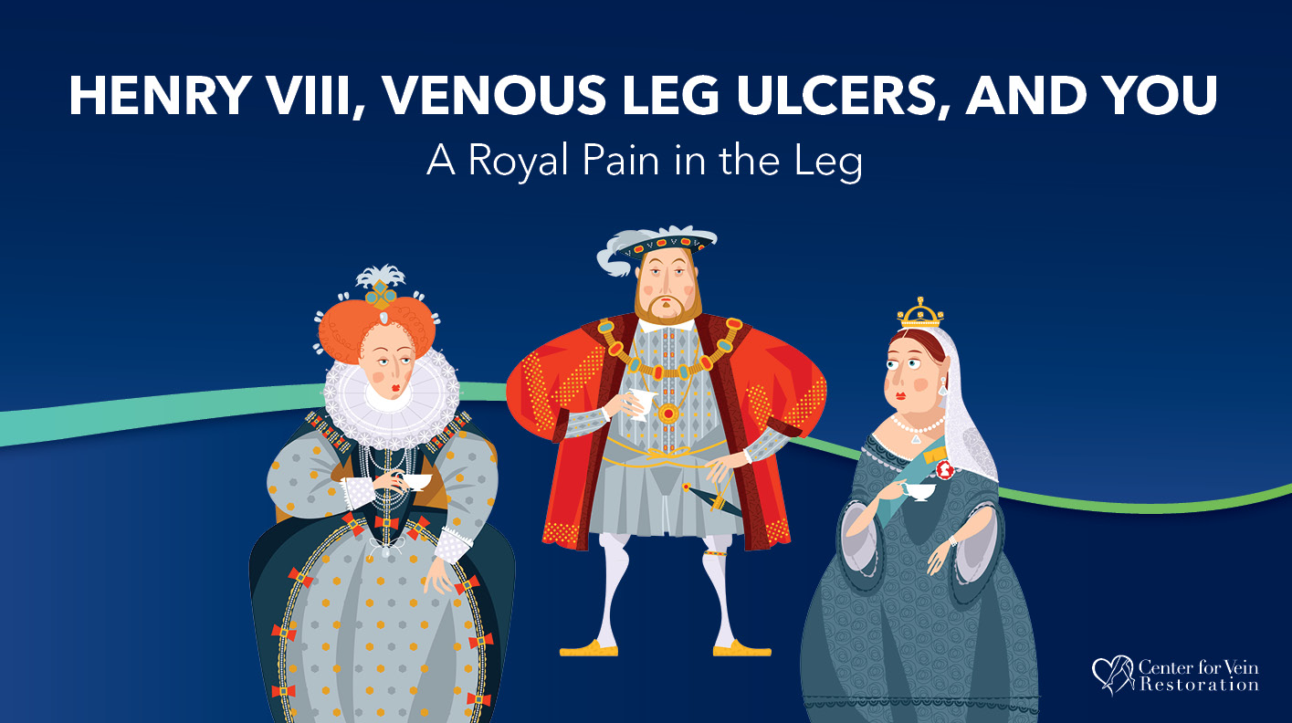 Blog Image Henry VIII