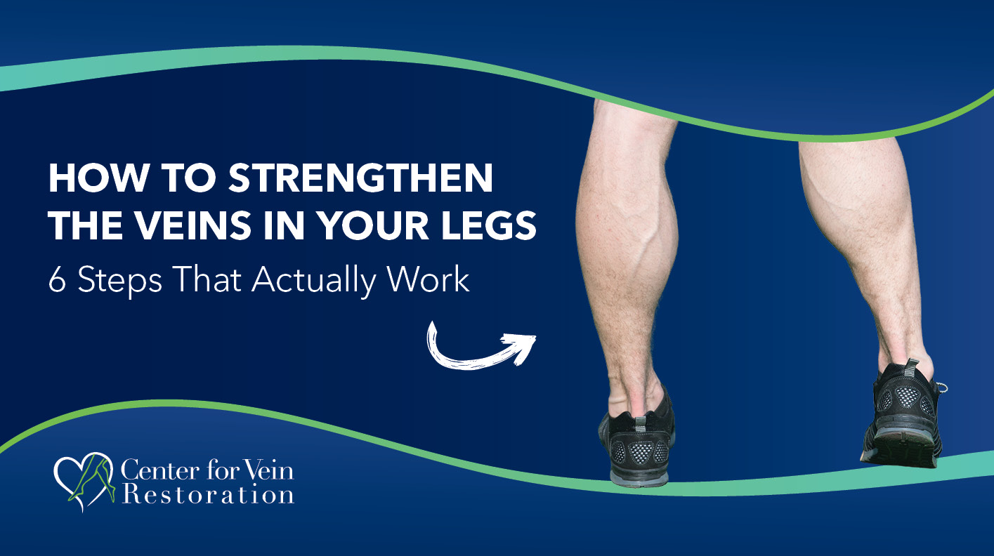 Blog Image How to Strengthen the Veins in Your Legs 6 Steps That Actually Work