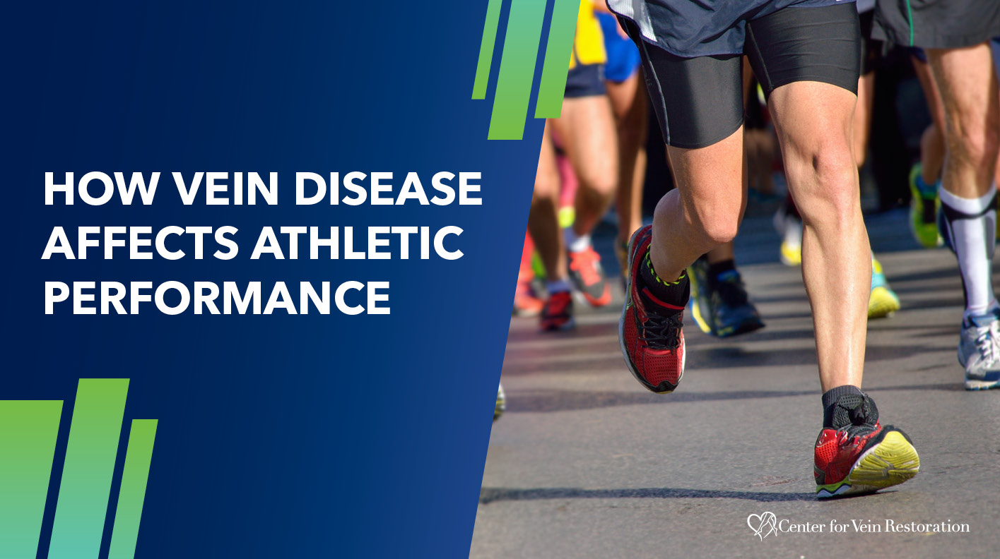 Blog Image How Vein Disease Affects Athletic Performance