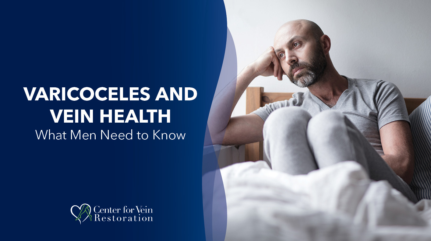 Blog Image Varicoceles and Vein Health