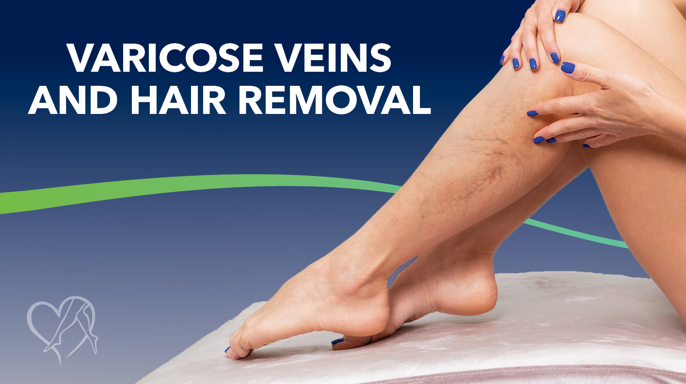 Blog Image Varicose Veins And Hair Removal Thunbnail
