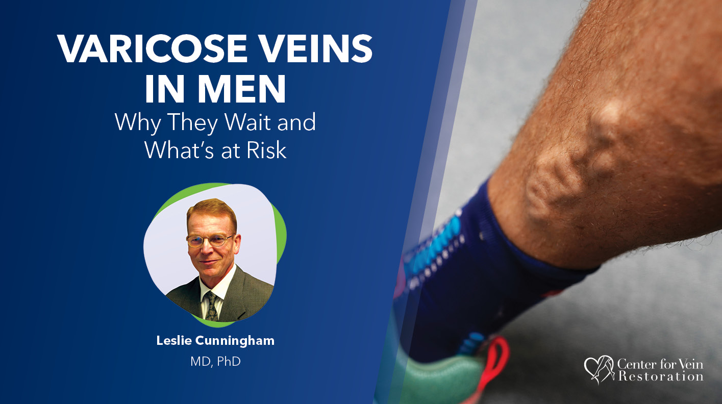 Blog Image Varicose Veins In Men