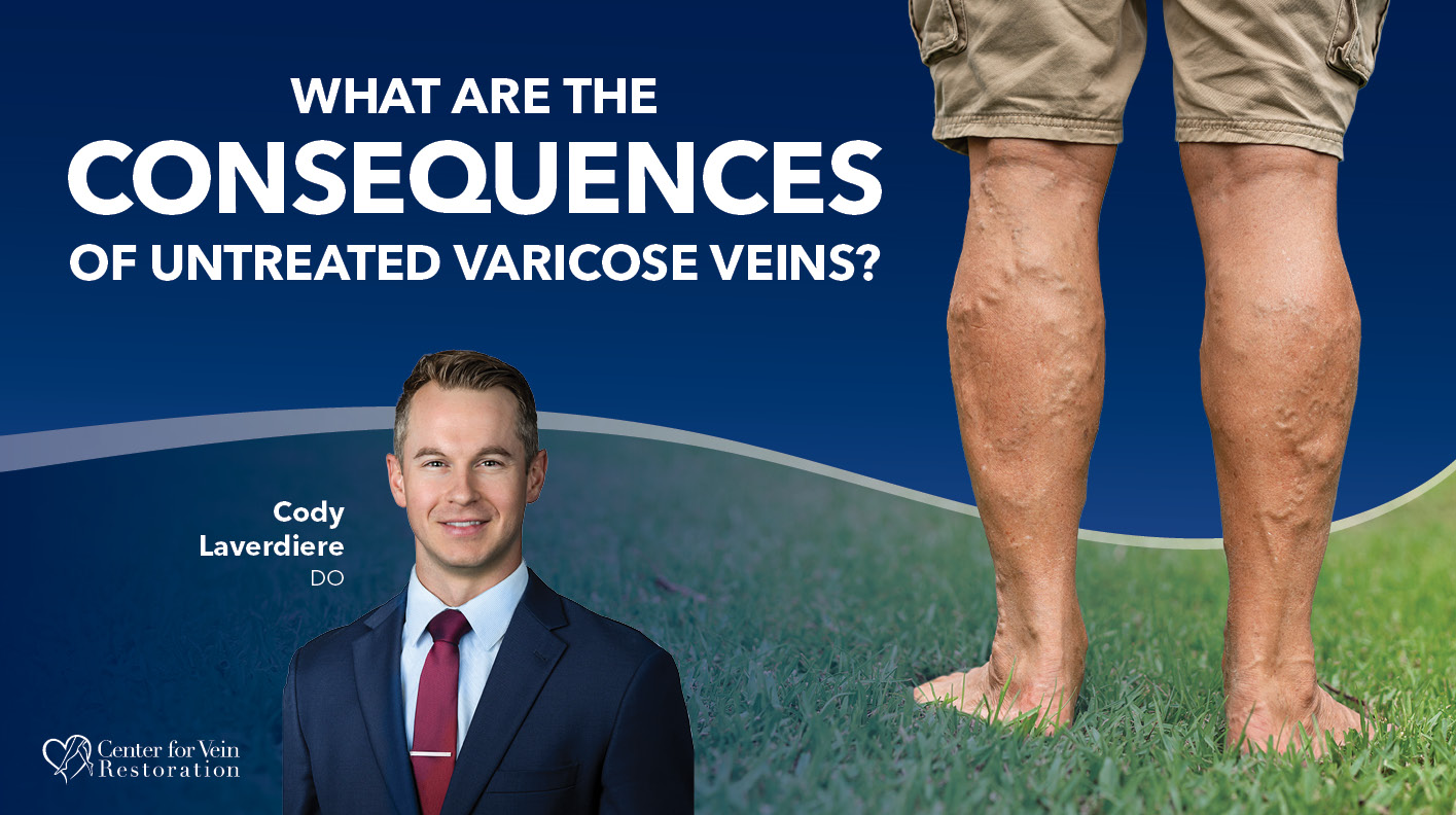 Blog Image What Are the Consequences of Untreated Varicose Veins