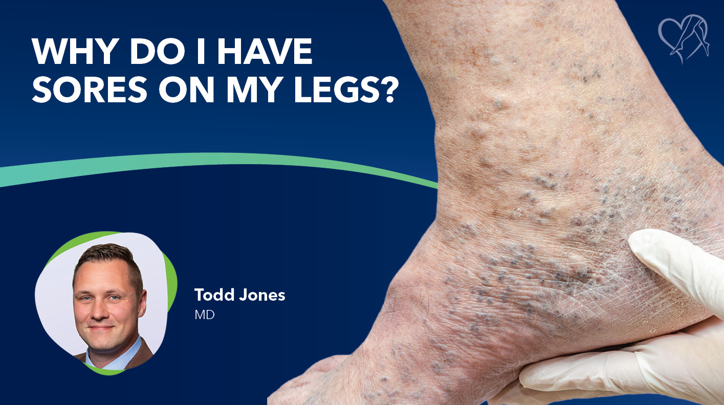 Blog Image Why Do I Have Sores on My Legs