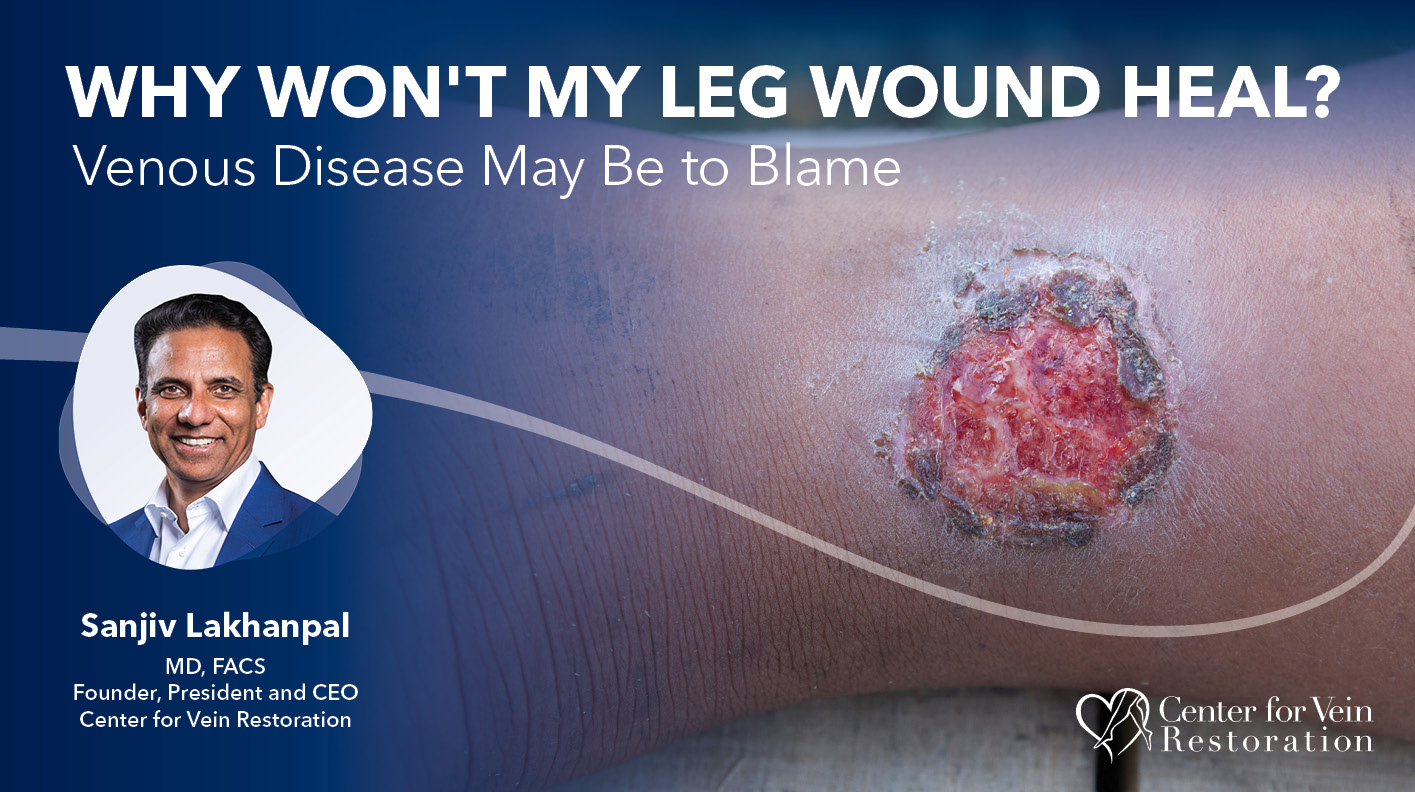 Blog Image Why Wont My Leg Wound Heal