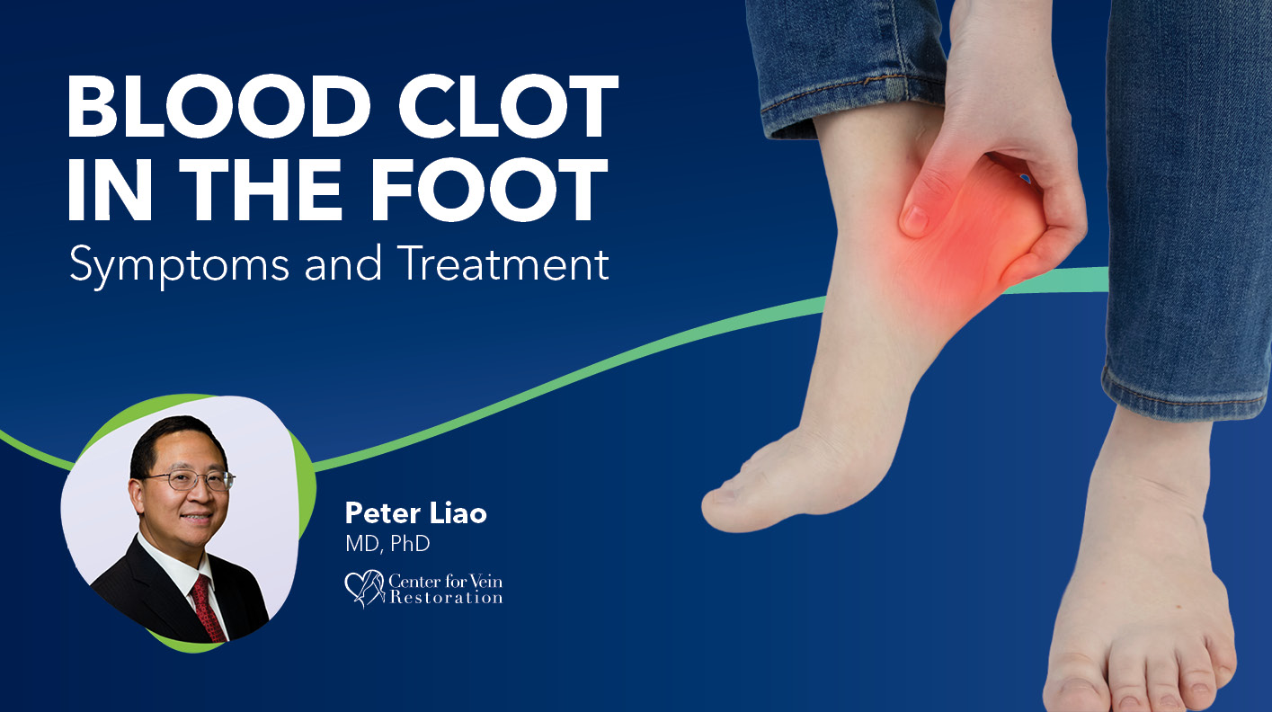 Blog Blood Clot In The Foot