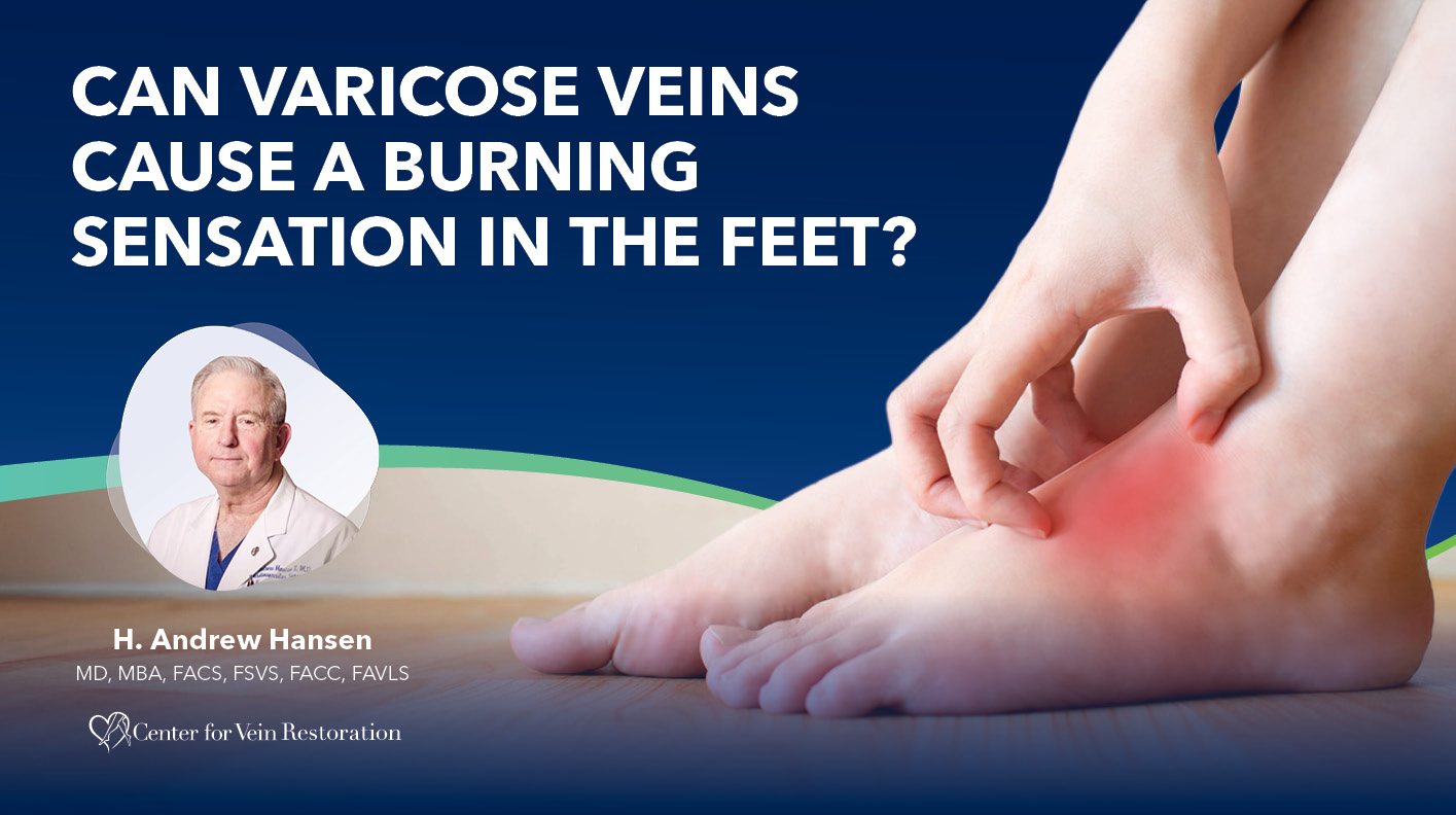 Blog Can Varicose Veins Cause a Burning Sensation in the Feet