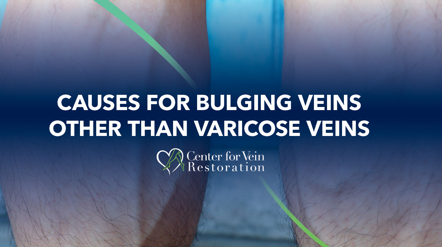 Blog Causes For Bulging Veins Other Than Varicose Veins 2026