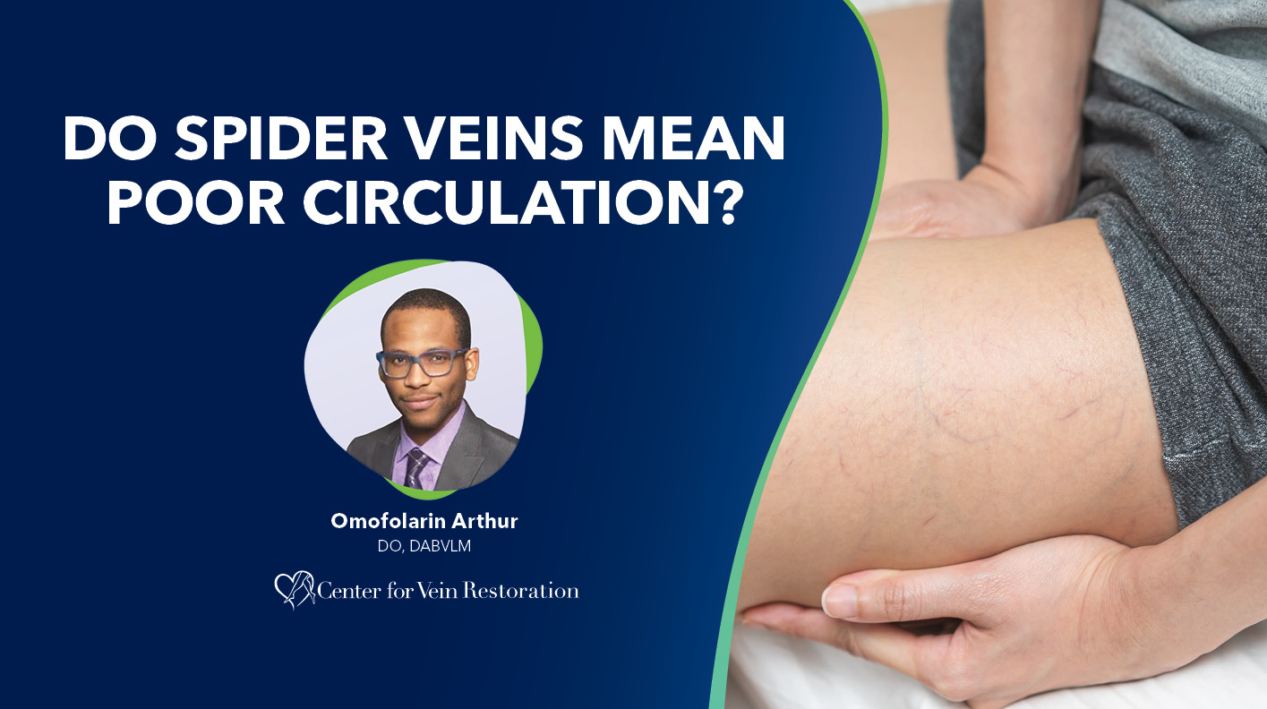 Blog Do Spider Veins Mean Poor Circulation