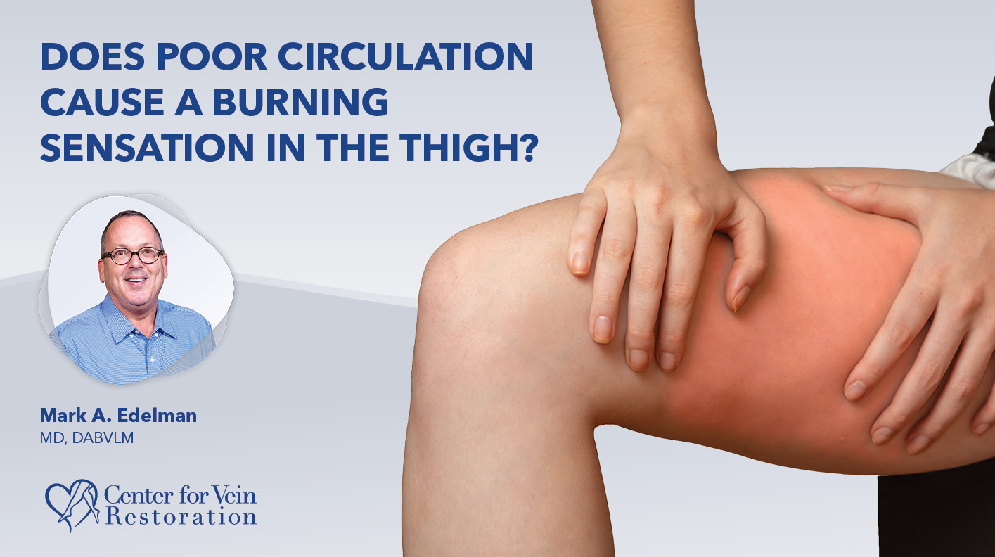 Blog Does Poor Circulation Cause a Burning Sensation in the Thigh