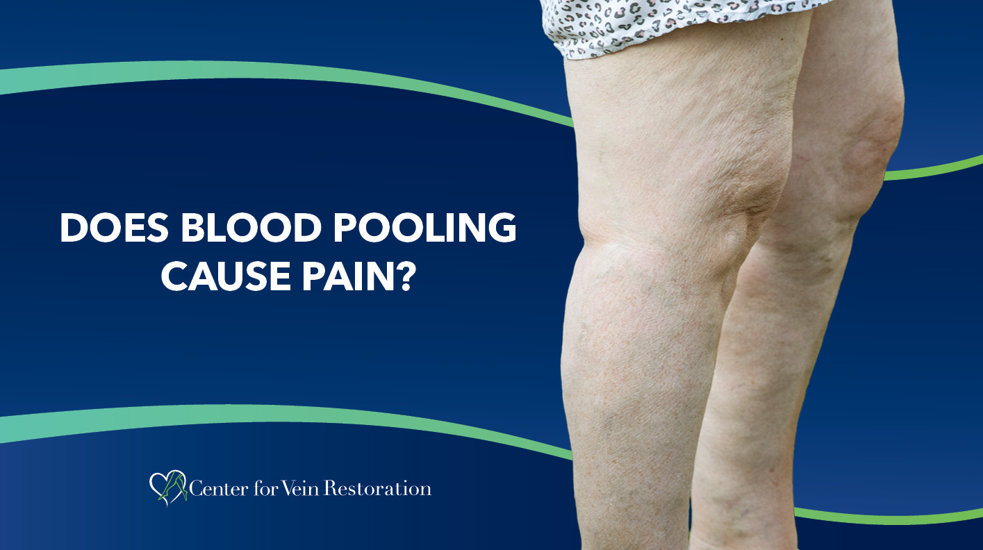 Blog Does Blood Pooling Cause Pain