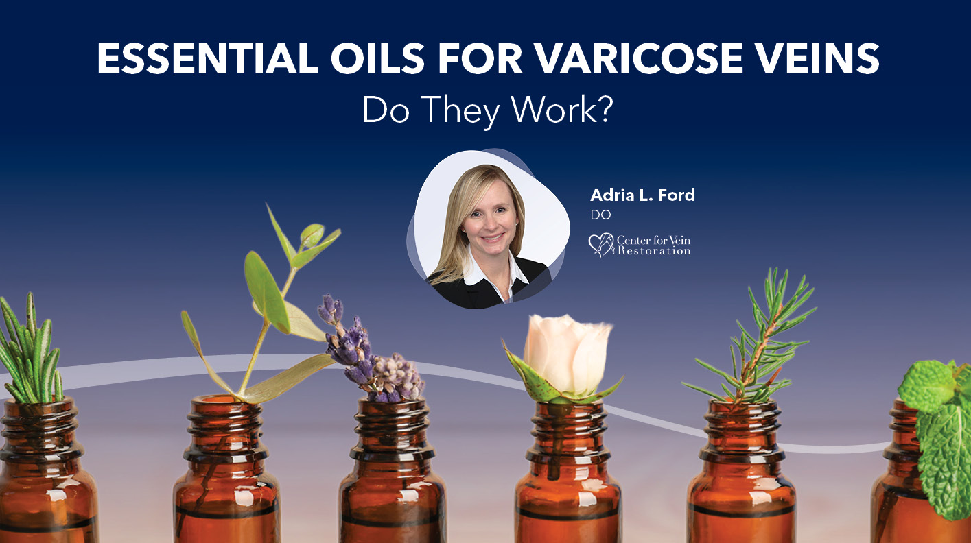 Blog Essential Oils For Varicose Veins