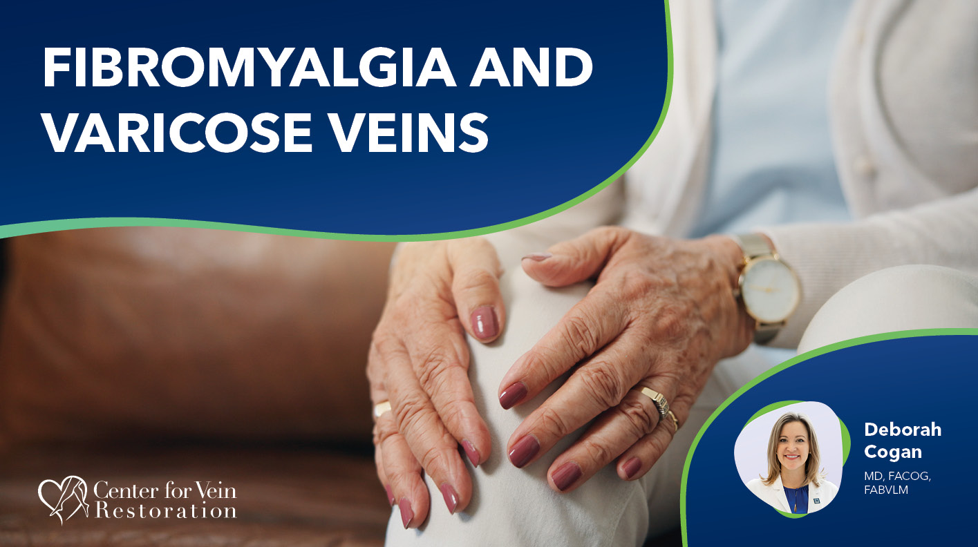 Blog Fibromyalgia and Varicose Veins