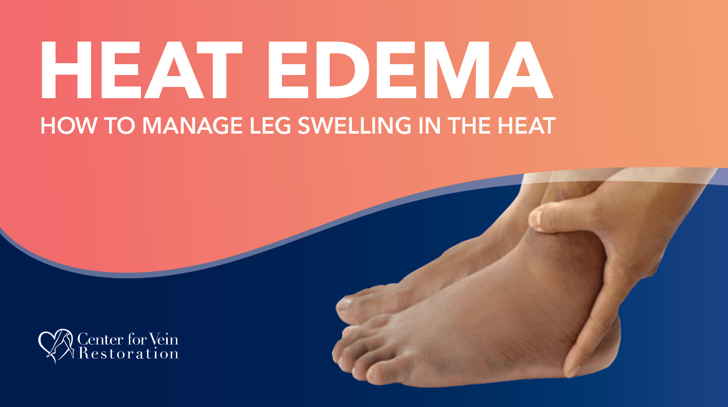 Blog Heat Edema 2026