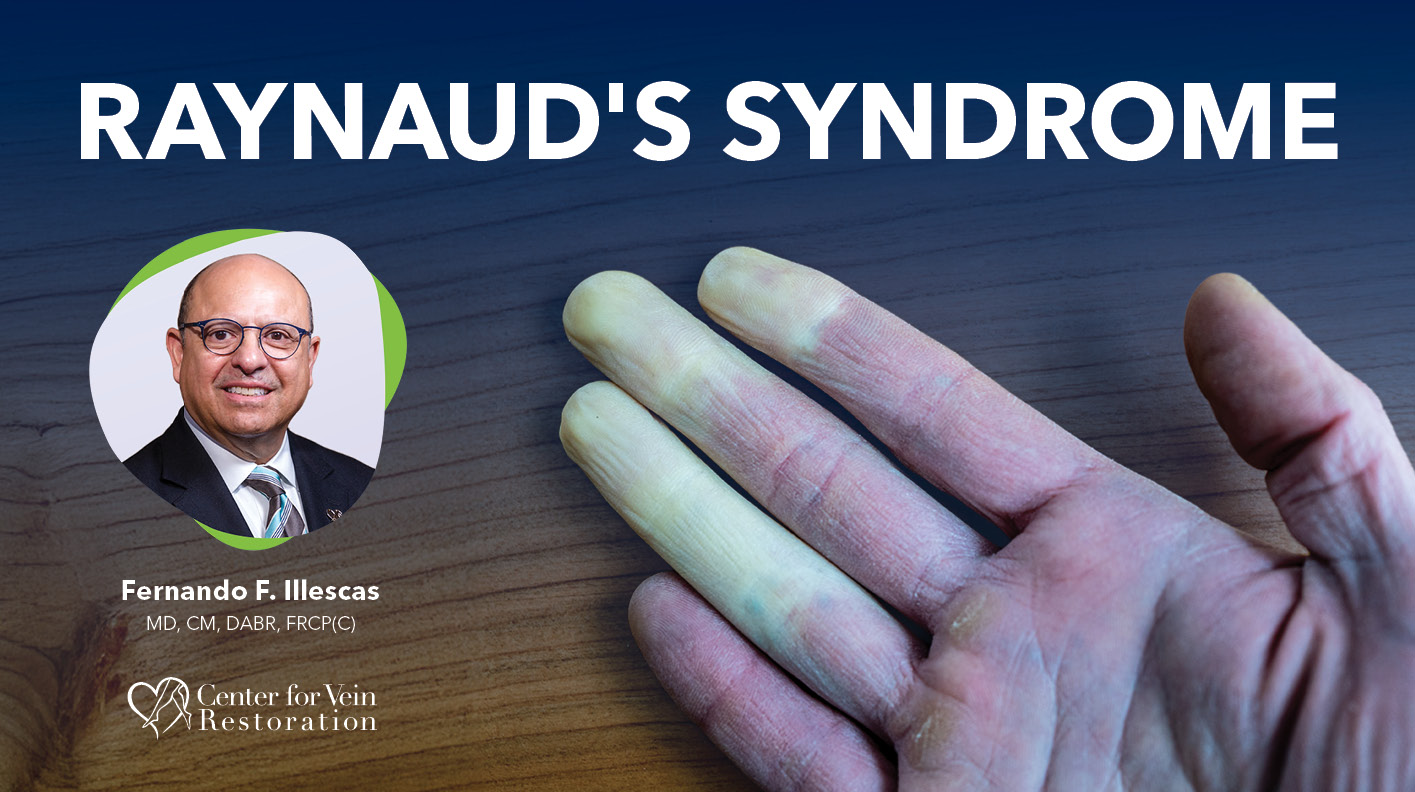 Blog Raynauds Syndrome
