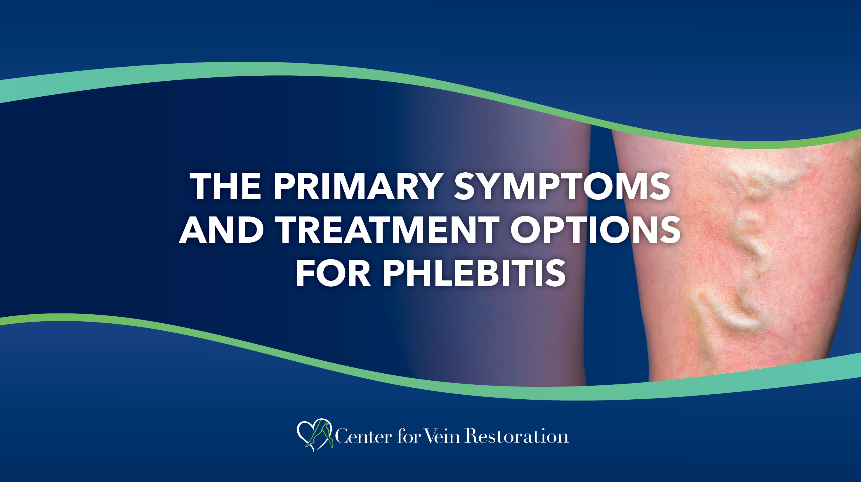 Blog The Primary Symptoms and Treatment Options for Phlebitis