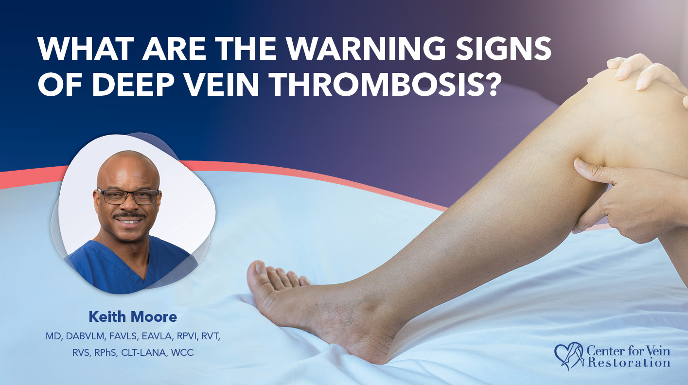 Blog What Are The Warning Signsof DVT