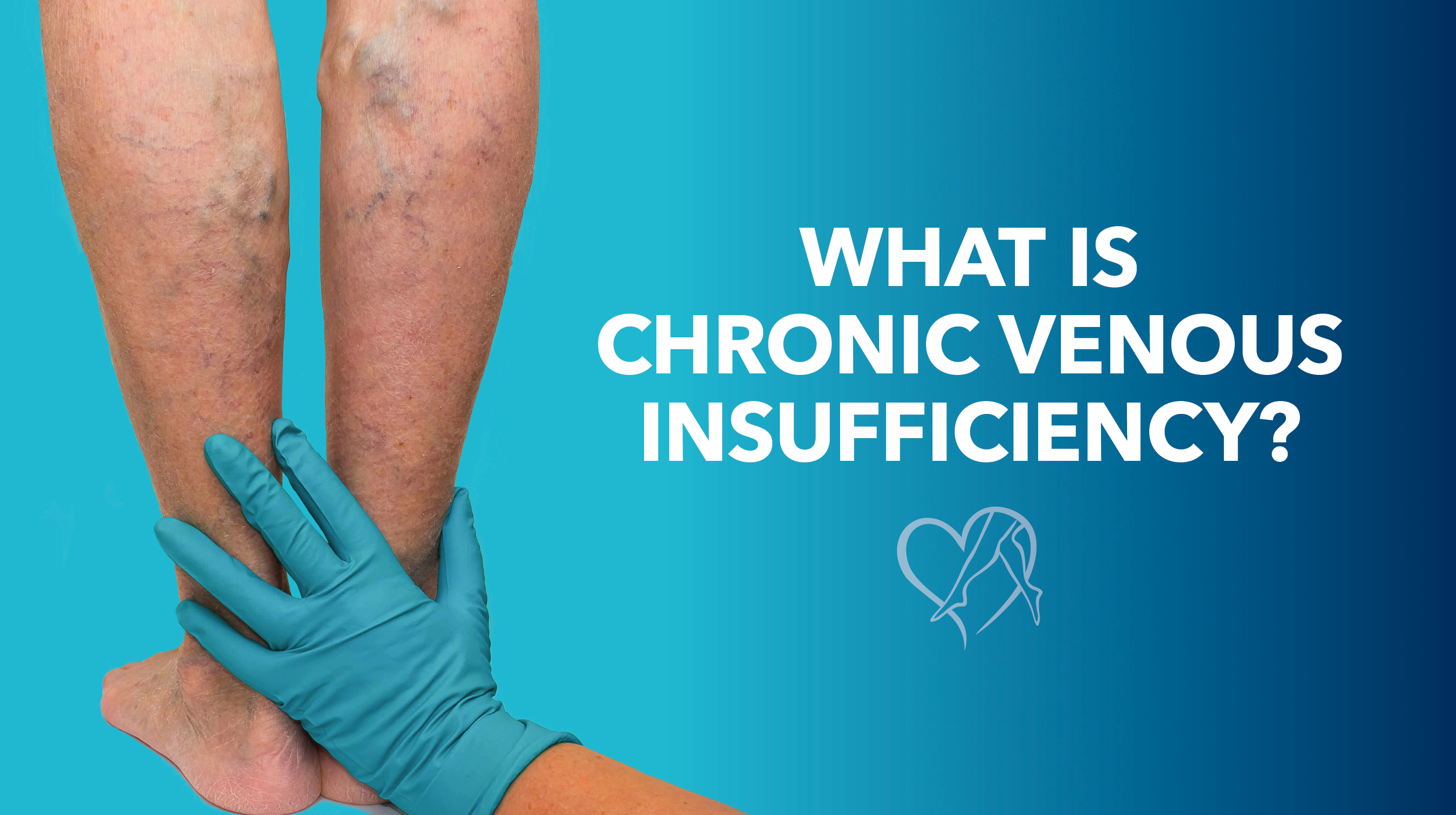 Blog What Is CVI Thumbnail