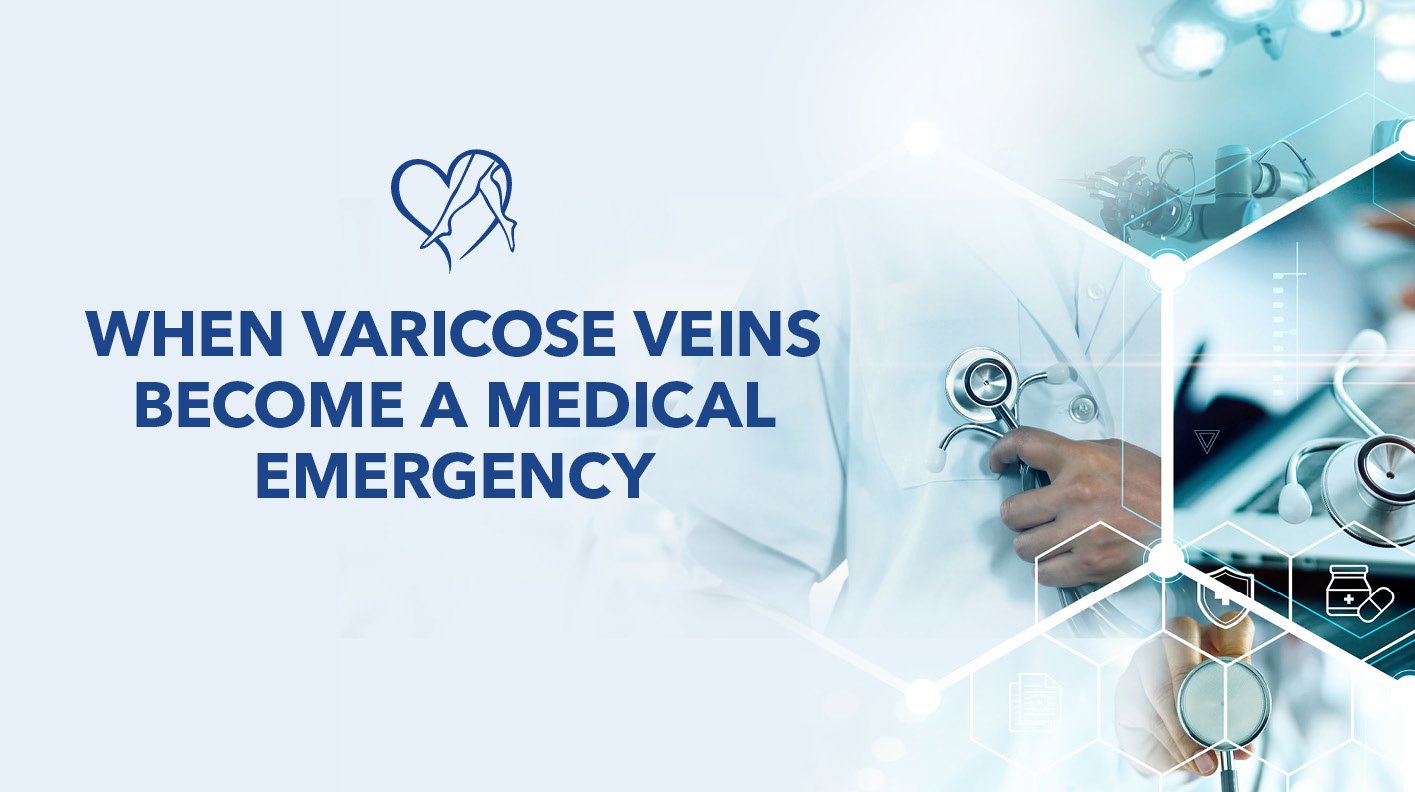 Blog When Varicose Veins Become A Medical Emergency