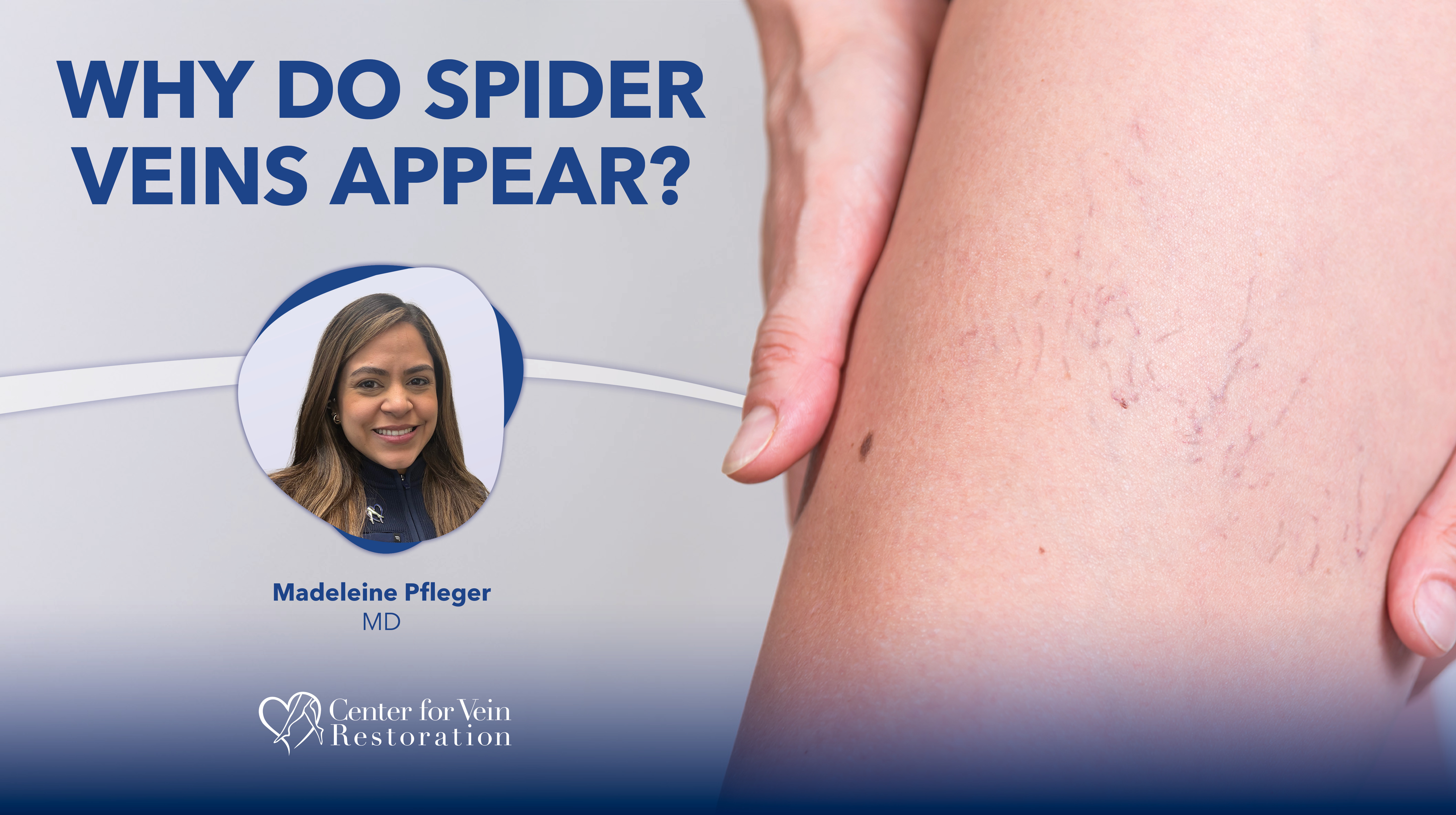 Blog Why Do Spider Veins Appear