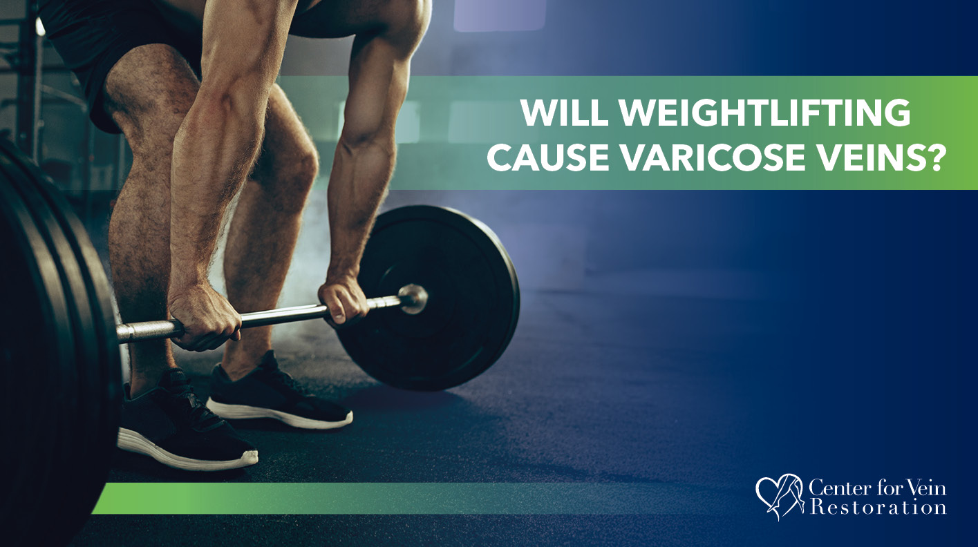 Blog Will Weight Lifting Cause Varicose Veins