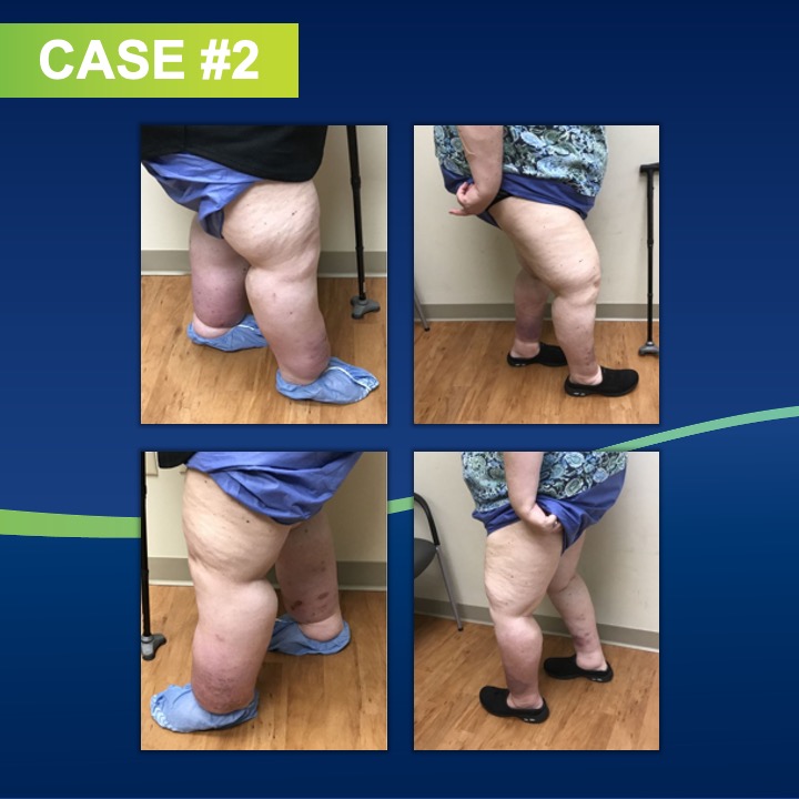 Slide6