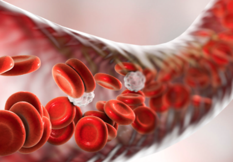 Center for Vein Restoration | Dr. Czestochowa Francois