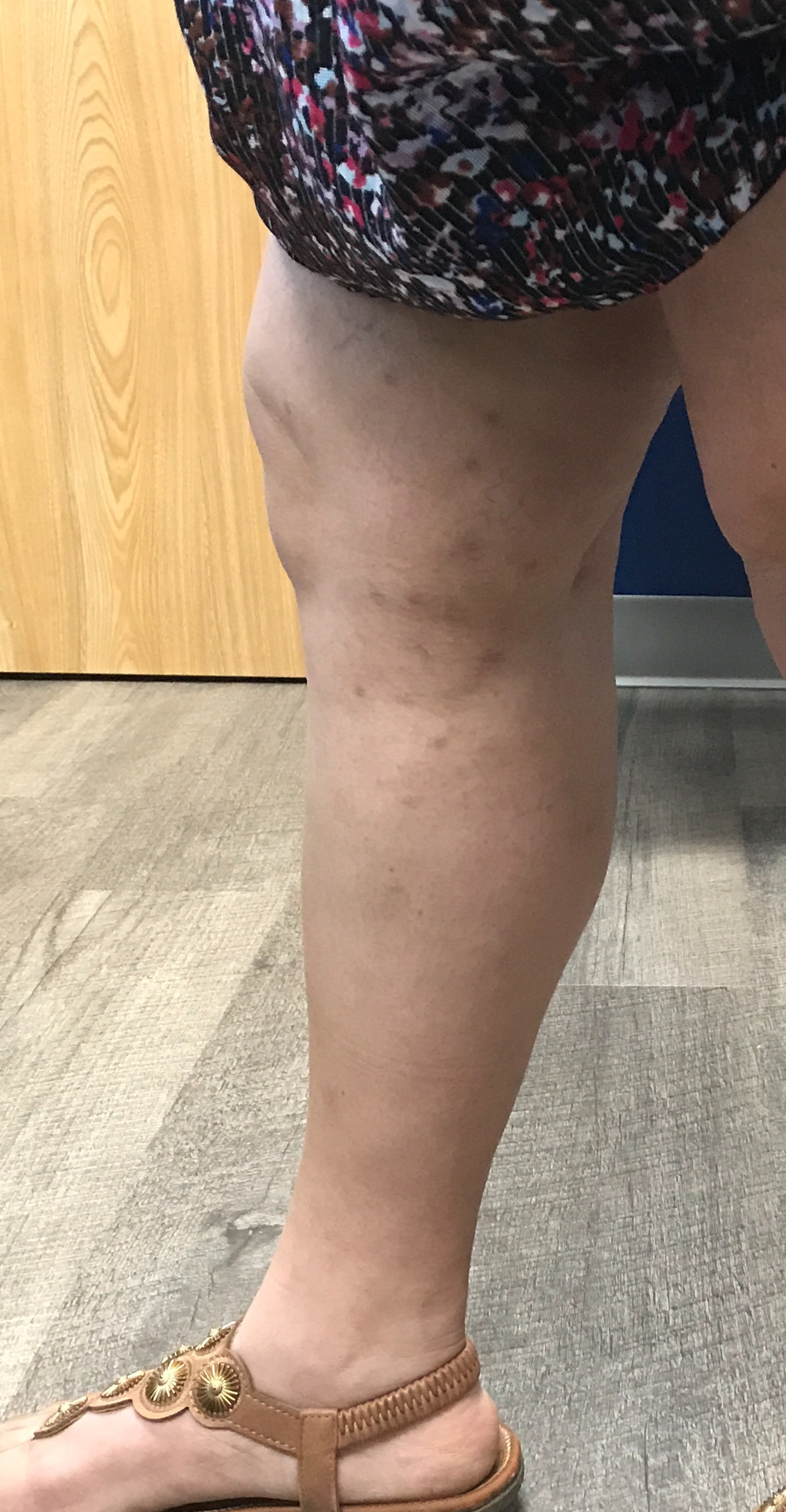 Aditya Gupta Pt 1 Post 4 jpg