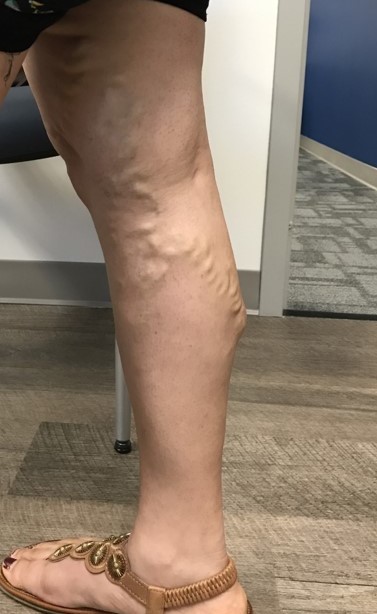 Aditya Gupta Pt 1 Pre 4