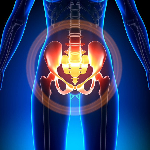 Animation of pelvic pain