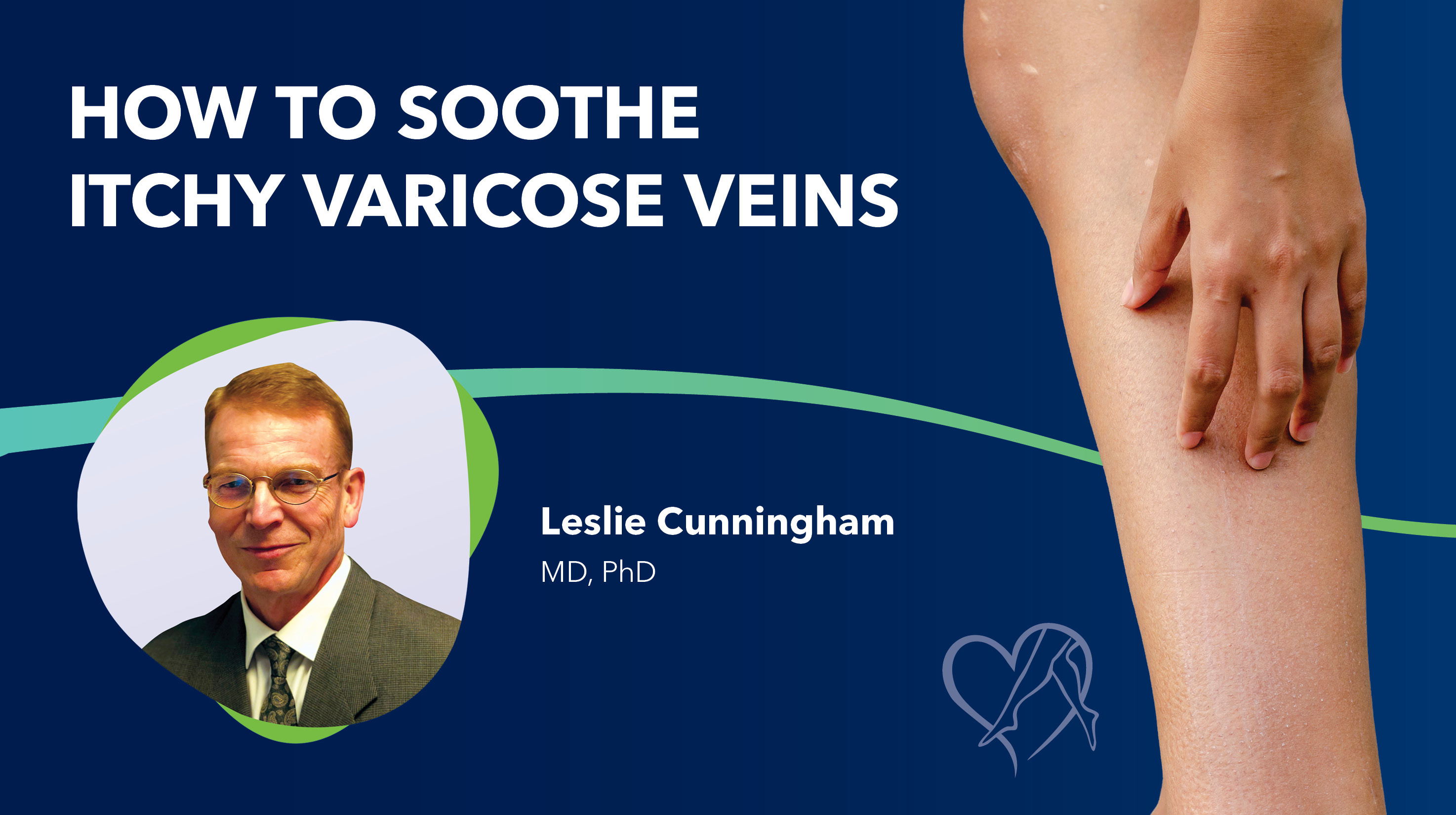 Blog How To Soothe Itchy Varicose Veins Thumbnail