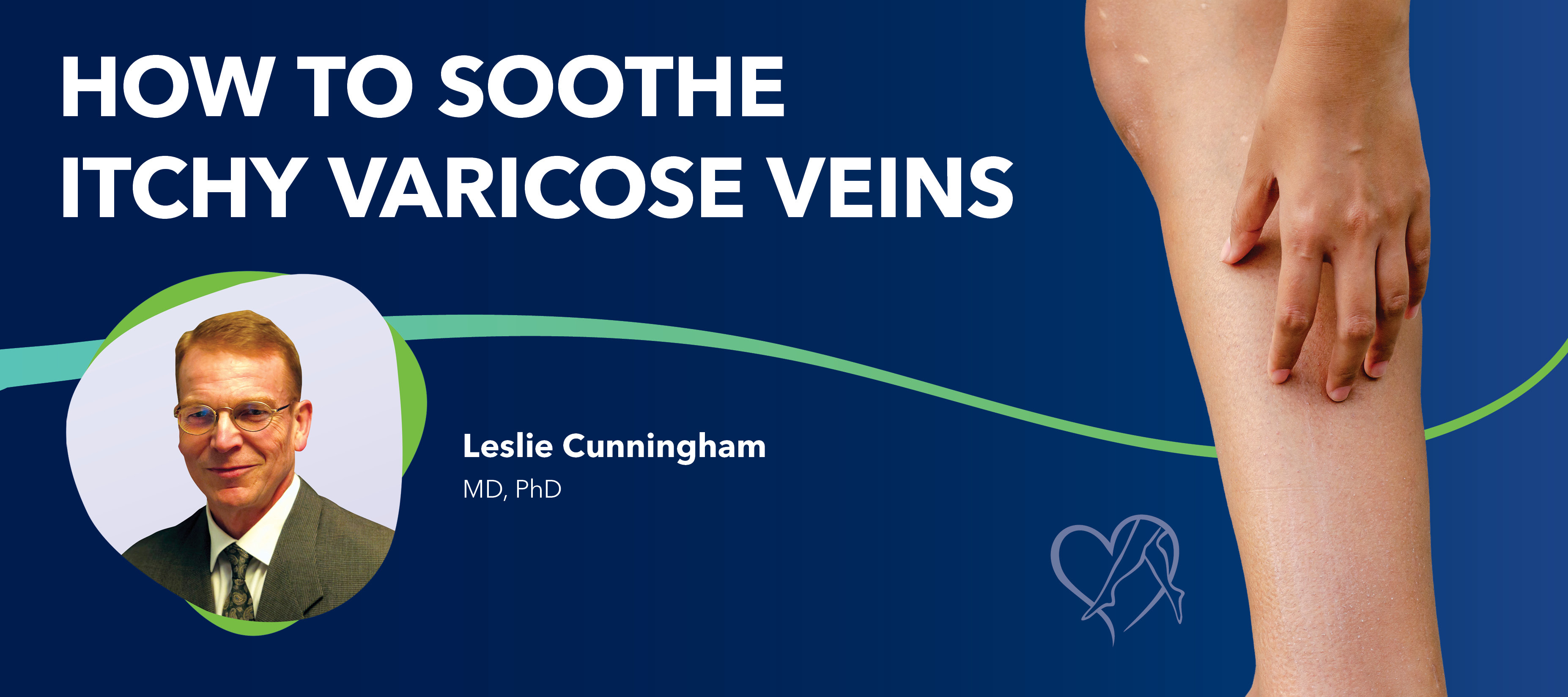 Blog How To Soothe Itchy Varicose Veins