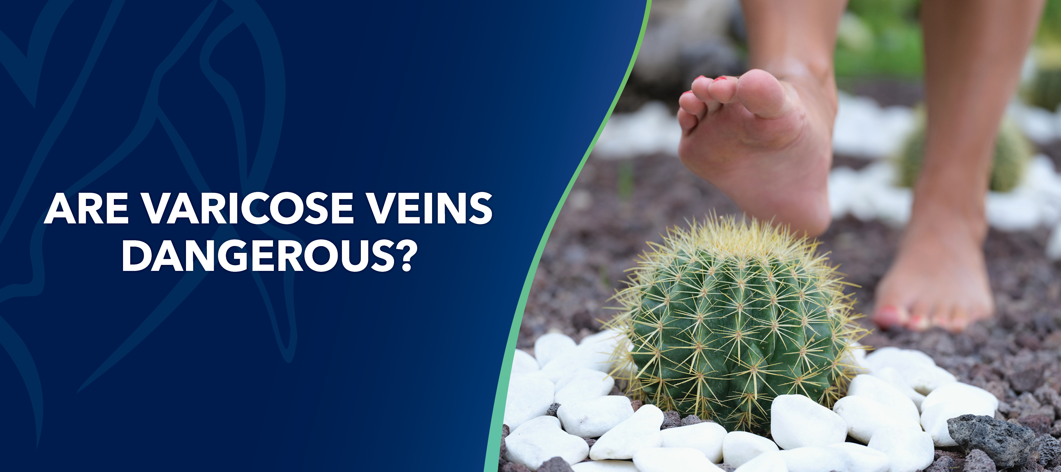 Blog Image Are Varicose Veins Dangerous