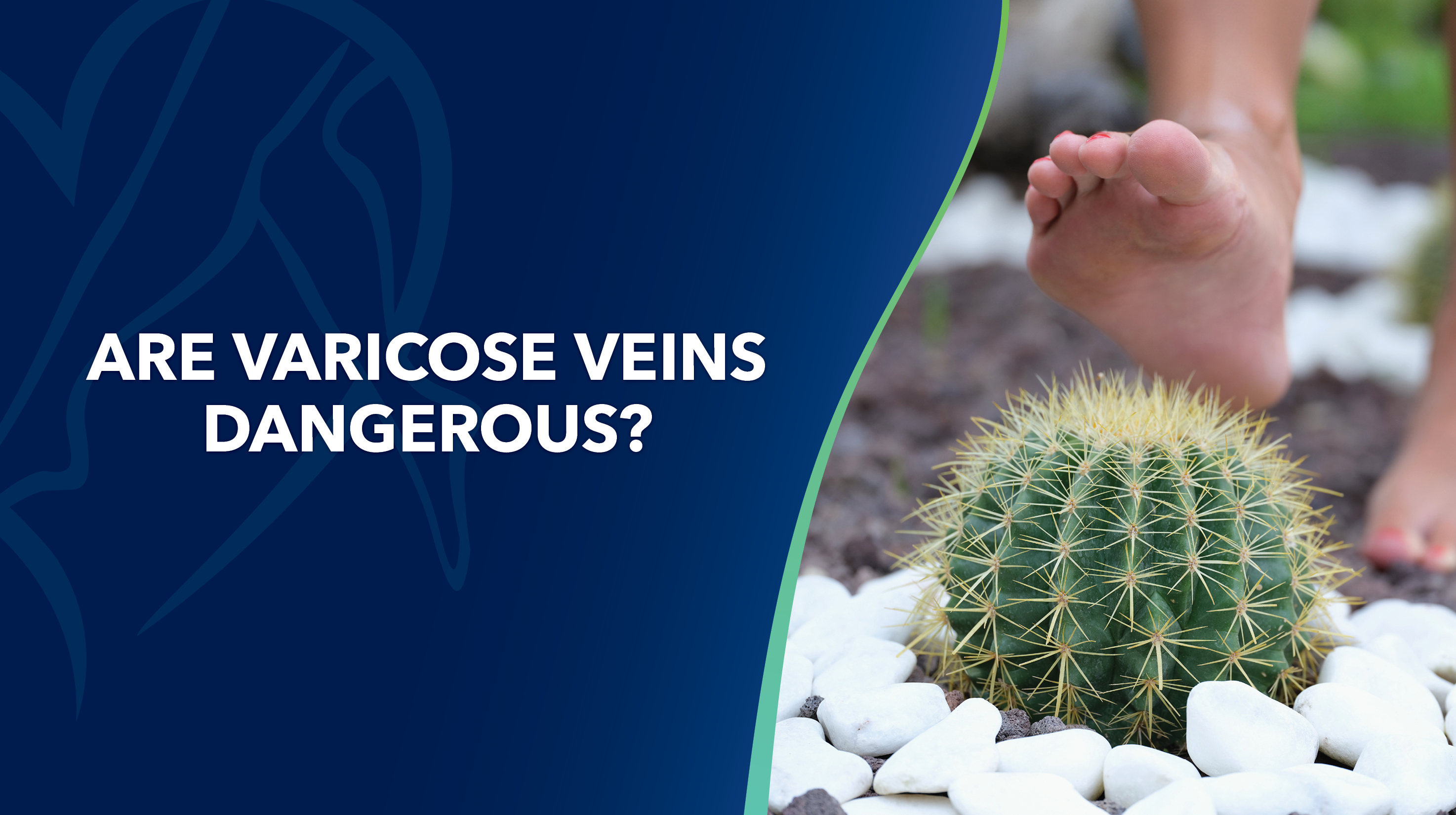 Blog Image Are Varicose Veins Dangerous Thumbnail