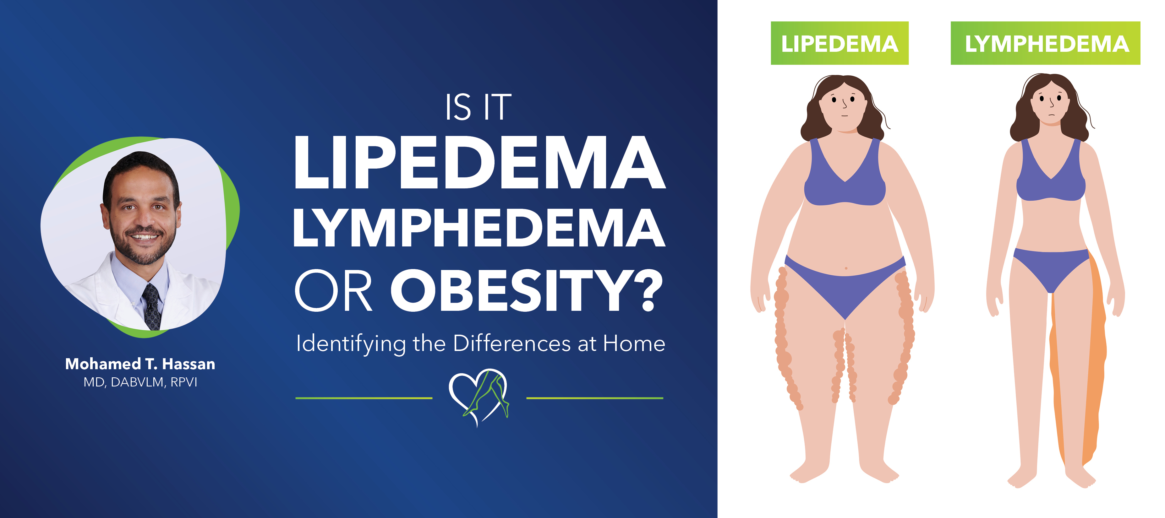 https://cdn.craft.cloud/4f7c8d17-0c96-40cd-89a4-3f6a0150b271/assets/images/Blog-Image_DrHassan_IsItLipedema_Lymphedema_Obesity.jpg?width=360&quality=80&fit=contain&s=pKR6llKFg3sYvcmD1rzEo-Wtfw0HiXXKTLhE2aS0L0Y