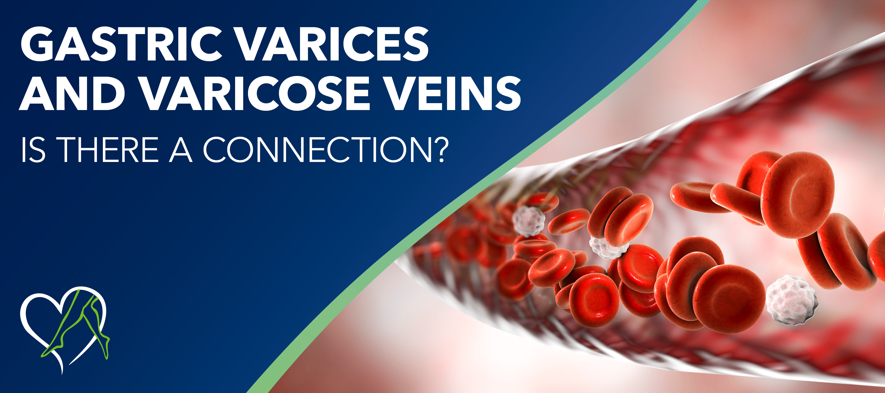 Blog Image Gastric Varices