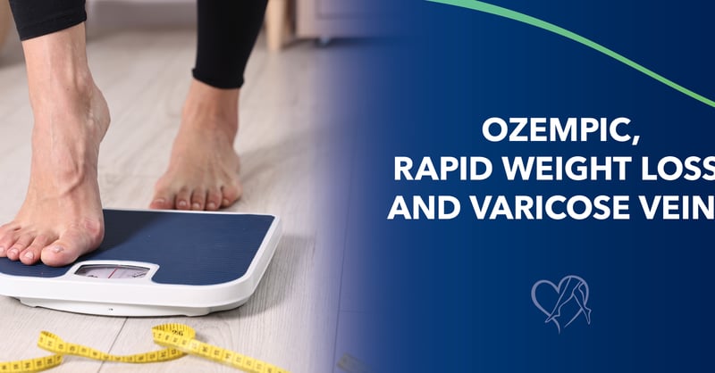 glp 1 and varicose veins Ozempic, Rapid Weight Loss, and Varicose Veins: Understanding the Connection glp 1 and varicose veins Ozempic, Rapid Weight Loss, and Varicose Veins: Understanding the Connection
