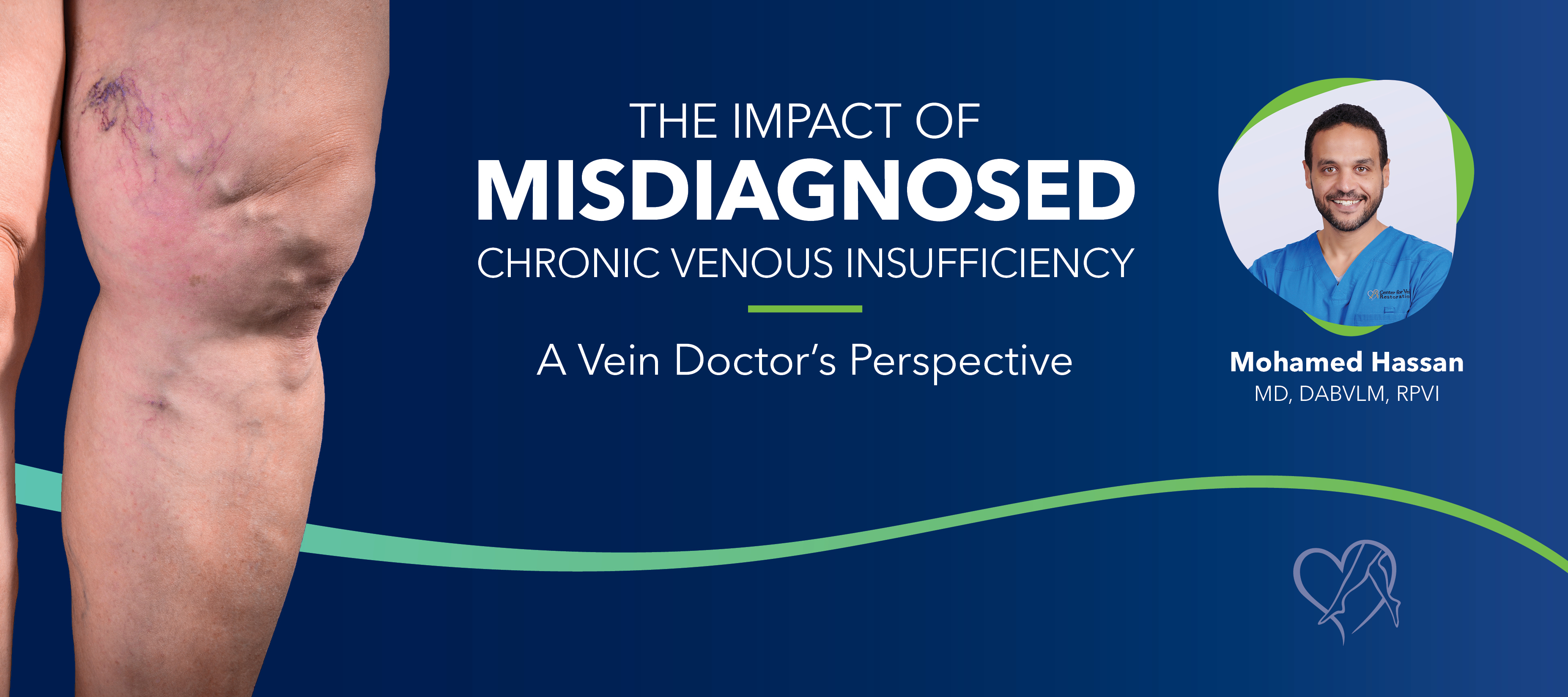 Blog Image The Impact Of Misdiagnosed Chronic Venous Insufficiency