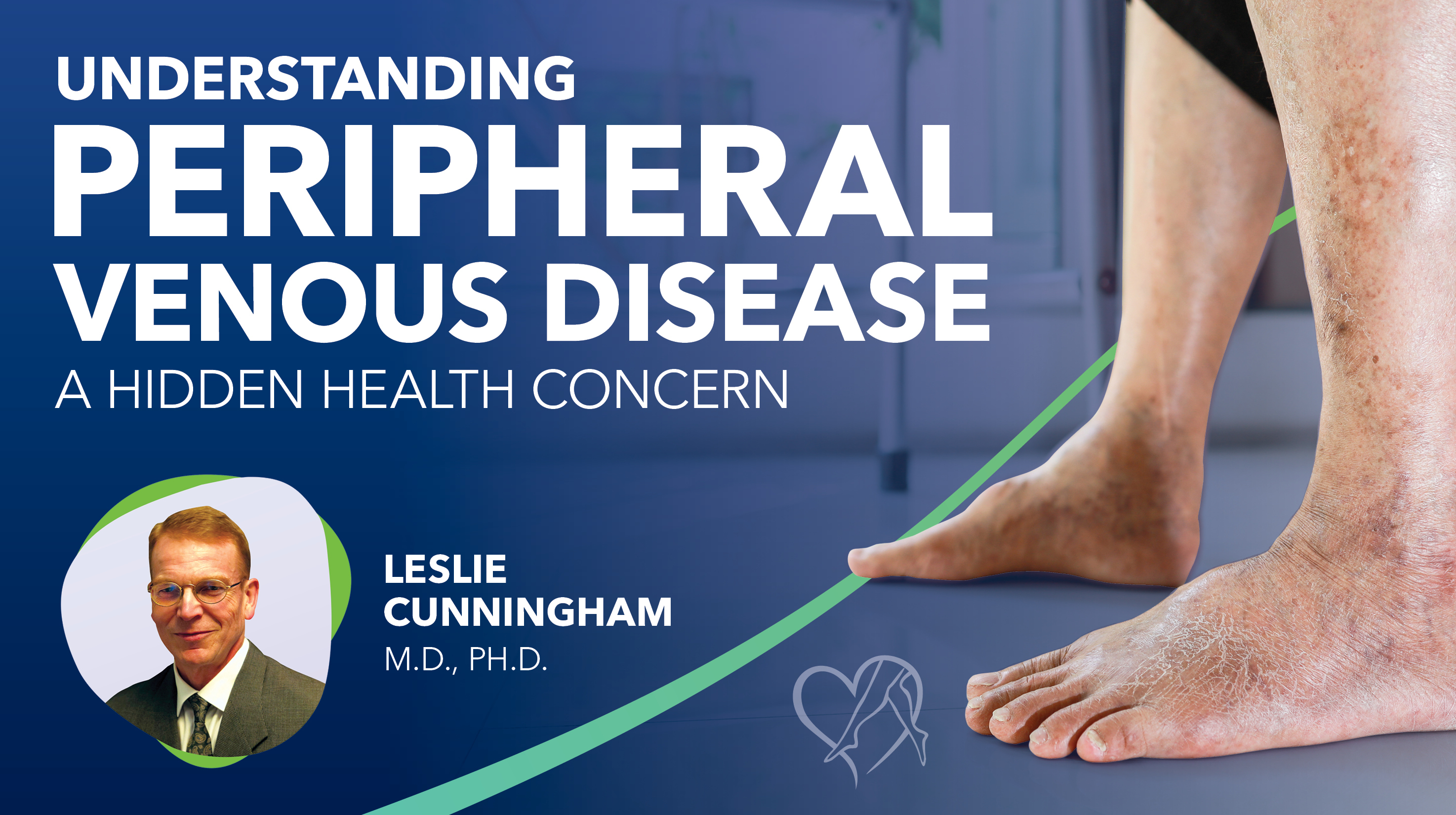 Blog Image Understanding Peripheral Venous Disease Thumbnail