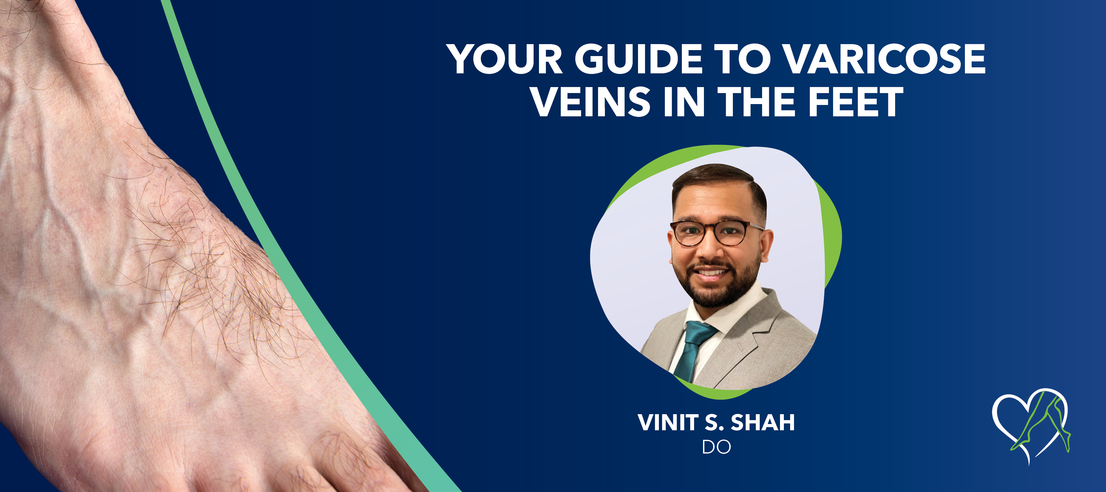 Blog Image Varicose Veins In Feet 1