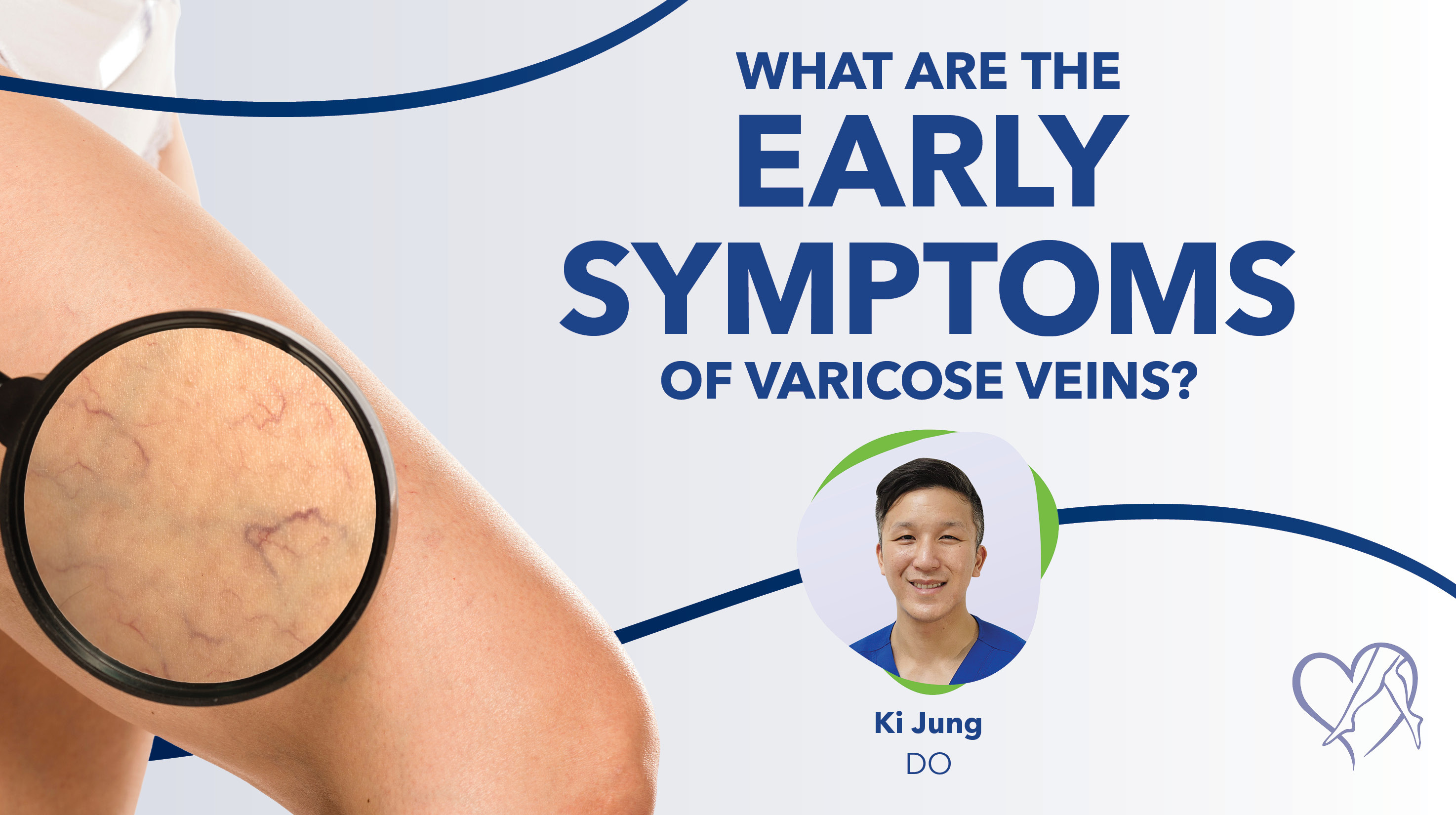 Blog What Arethe Early Symptoms Of Varicose Veins Thumbnail