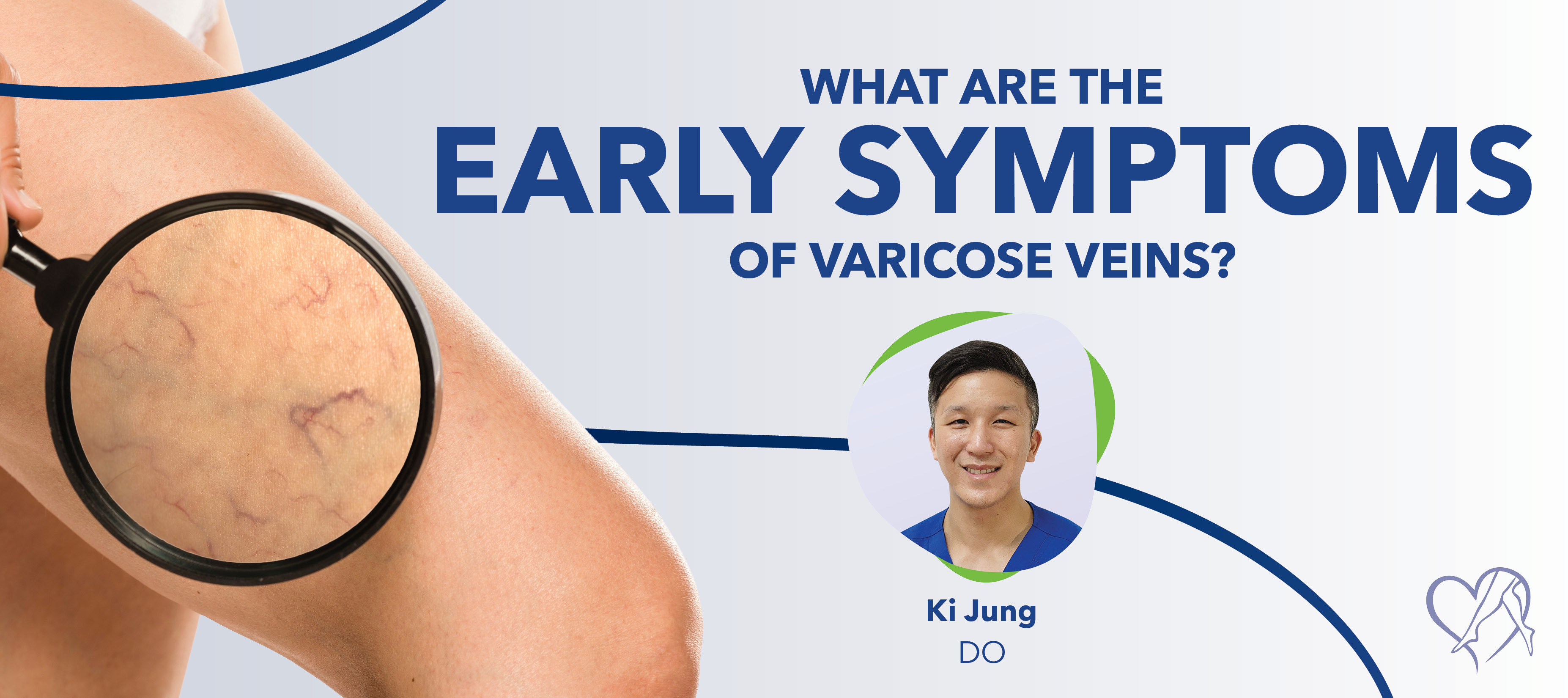 Blog What Arethe Early Symptoms Of Varicose Veins