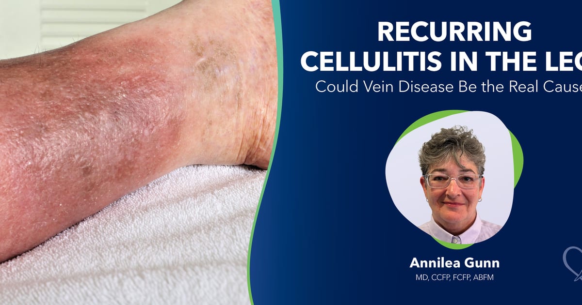 Cellulitis In Legs Recurring Cellulitis in the Legs: Could Vein Disease Be the Real Cause?